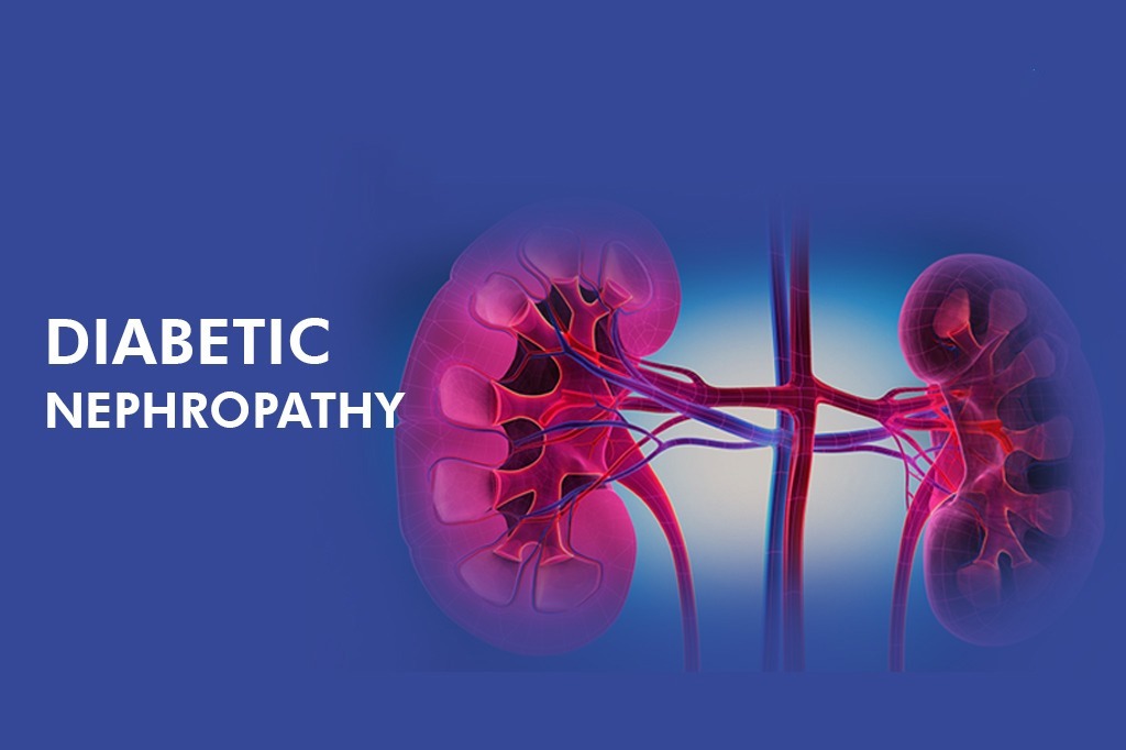 干細胞治療糖尿病腎病患者16例，能夠有效控制血糖，改善腎功能