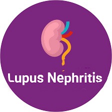 南京鼓樓醫(yī)院：干細胞治療92例狼瘡性腎炎，效果顯著！