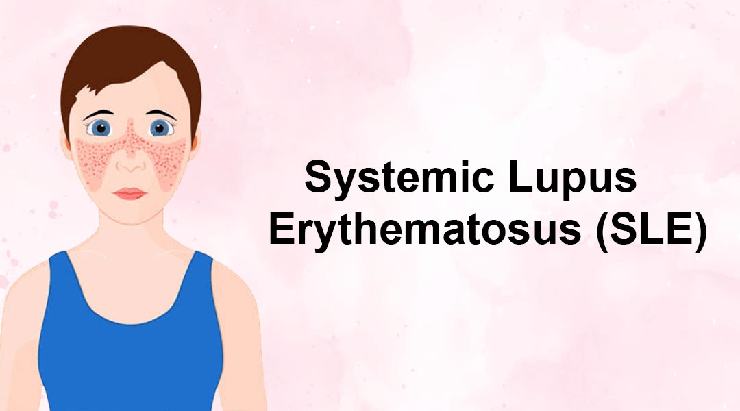 間充質(zhì)干細胞治療系統(tǒng)性紅斑狼瘡3大作用機制，你都了解嗎？