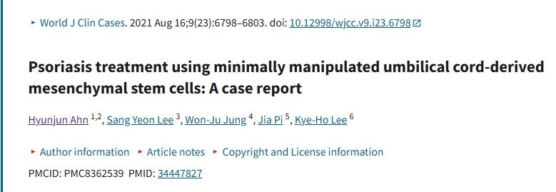 使用微操作臍帶來源的間充質(zhì)干細胞治療銀屑病：病例報告