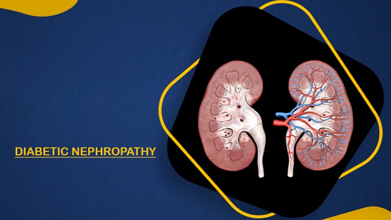 干細胞治療糖尿病腎病的安全性怎么樣?盤點國內外臨床進展! 干細胞治療糖尿病腎病的安全性怎么樣?盤點國內外臨床進展!