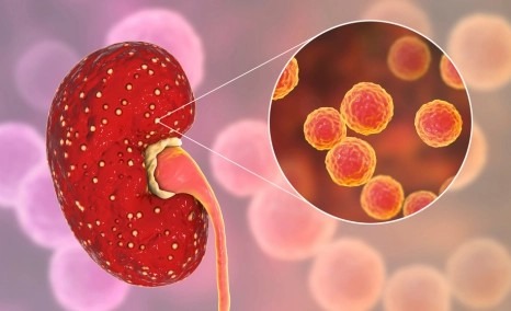 干細胞治療狼瘡性腎炎的安全性怎么樣?盤點國內外臨床進展! 干細胞治療狼瘡性腎炎的安全性怎么樣?盤點國內外臨床進展!