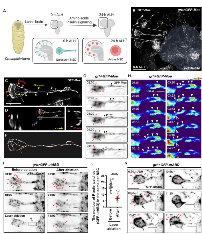 圖2：靜息態(tài)神經(jīng)干細胞再激活過程中的F-肌動蛋白結(jié)構(gòu)和動力學(xué)