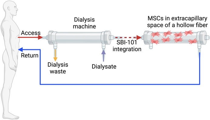 圖1：配備集成SBI-101系統的體外回路。