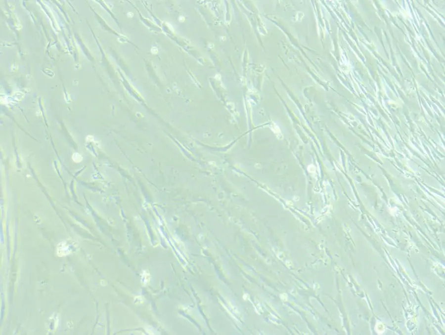 顯微鏡下的神經(jīng)干細(xì)胞。