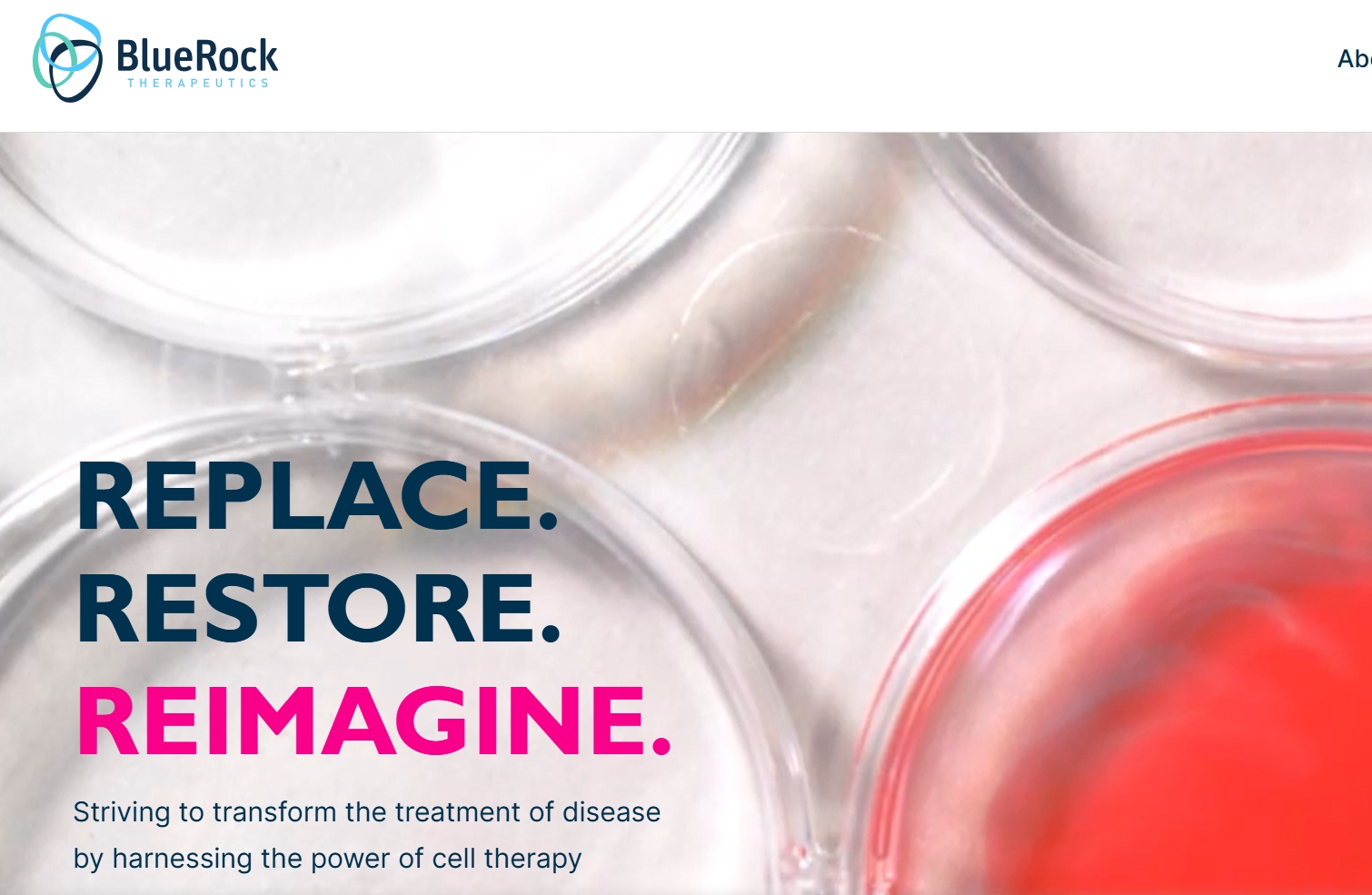 拜耳突破性干細胞治療帕金森病III期臨床試驗啟動，開啟治療新紀元！