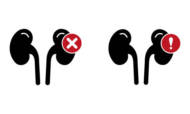 探索干細胞療法:能否成為降低腎病患者肌酐水平的新希望? 探索干細胞療法:能否成為降低腎病患者肌酐水平的新希望?