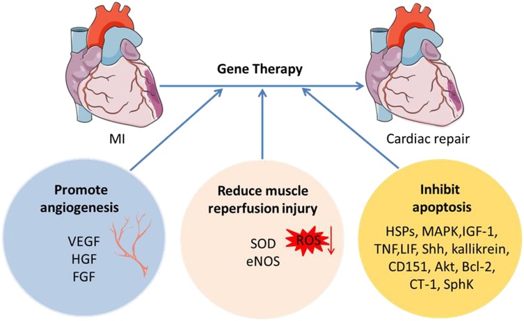 圖2：MI基因治療示意圖。