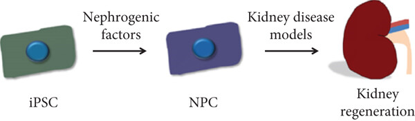 腎臟疾病中的 iPSC 衍生腎細胞 腎臟疾病中的 iPSC 衍生腎細胞