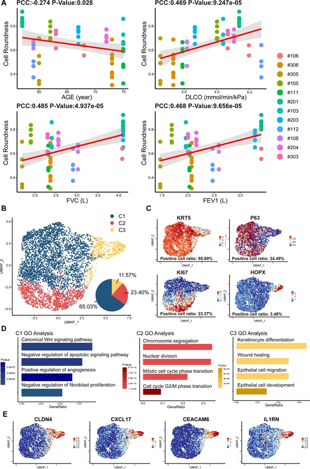 圖2：從IPF患者中分離的P63+肺祖細(xì)胞的細(xì)胞形態(tài)和單細(xì)胞RNA測(cè)序分析。
