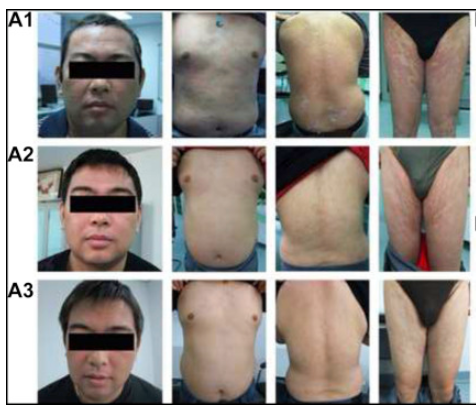 患者一治療前后的對比圖 患者一治療前后的對比圖