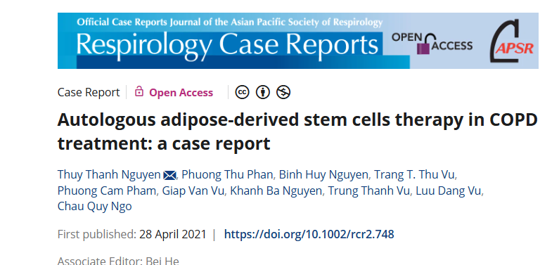 自體脂肪干細胞療法治療慢性阻塞性肺?。阂焕±龍蟾? class=