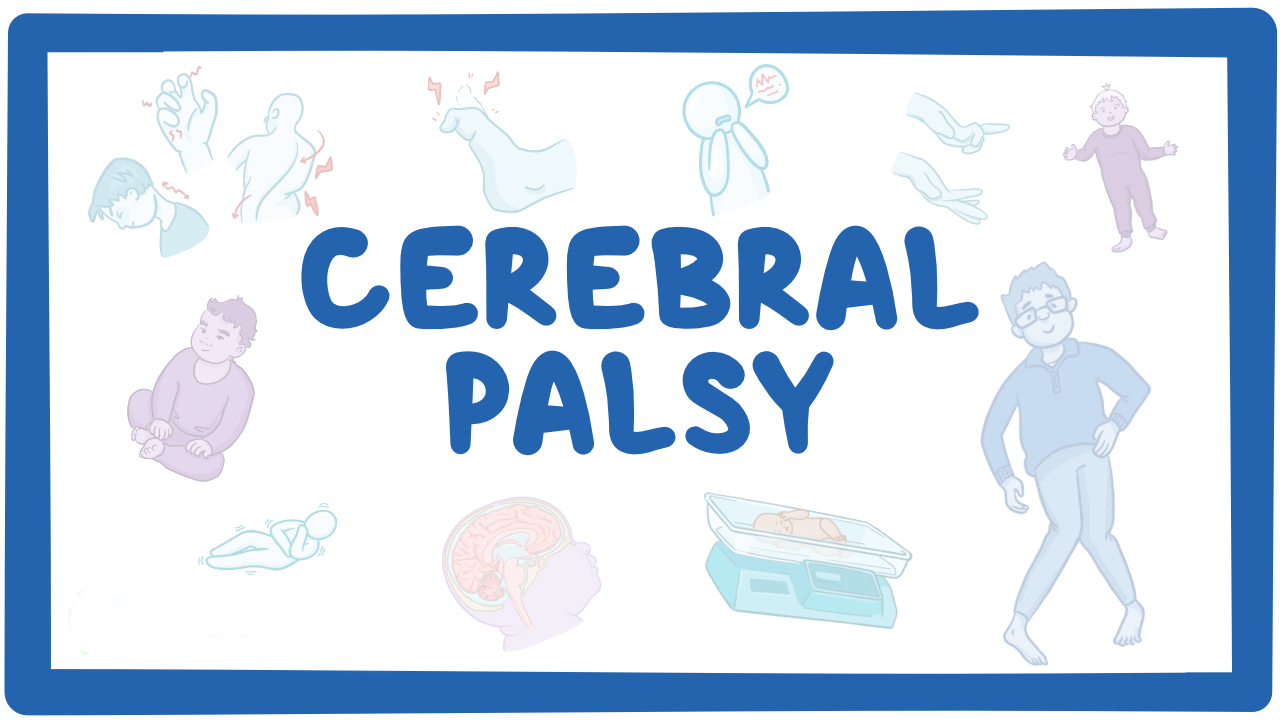 孩子腦癱有救了？神經干細胞移植治療腦癱的真實療效分享