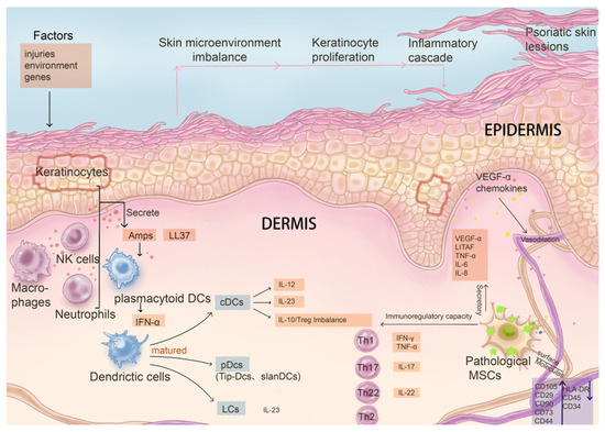 圖3：病理性間充質干細胞與關鍵免疫系統細胞及銀屑病發病因素的影響及相互作用。