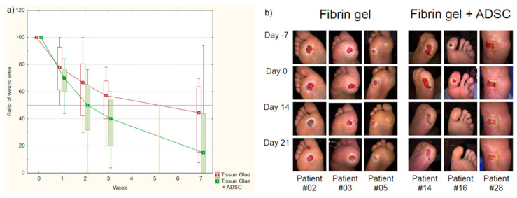 圖1：纖維蛋白凝膠組和AASC組患者治療進展對比。