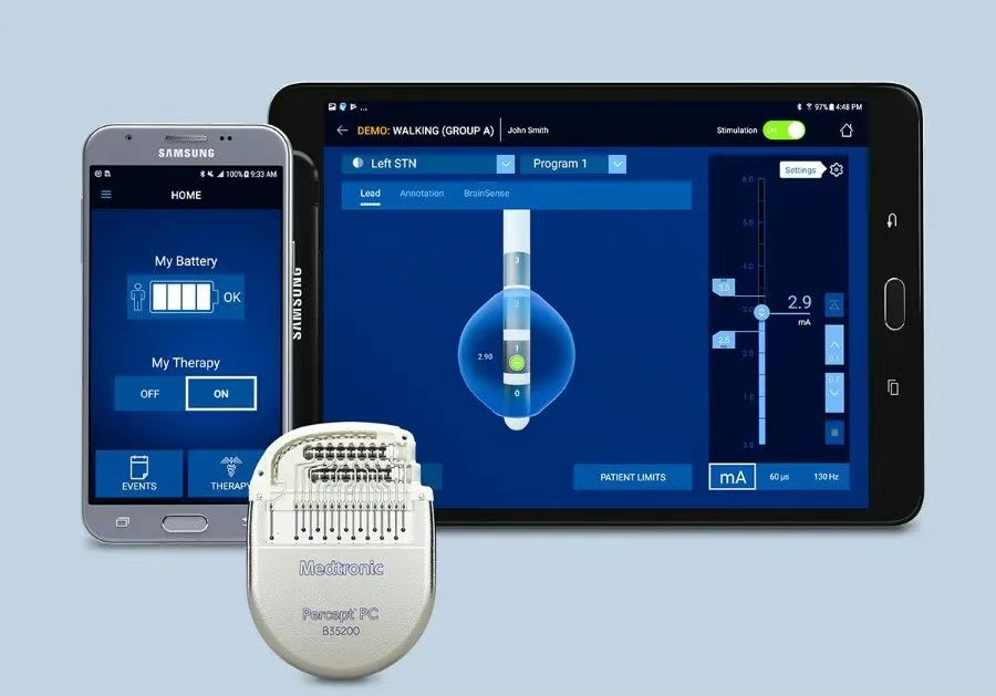 美敦力推出的BrainSense?自適應腦深部刺激（aDBS）系統