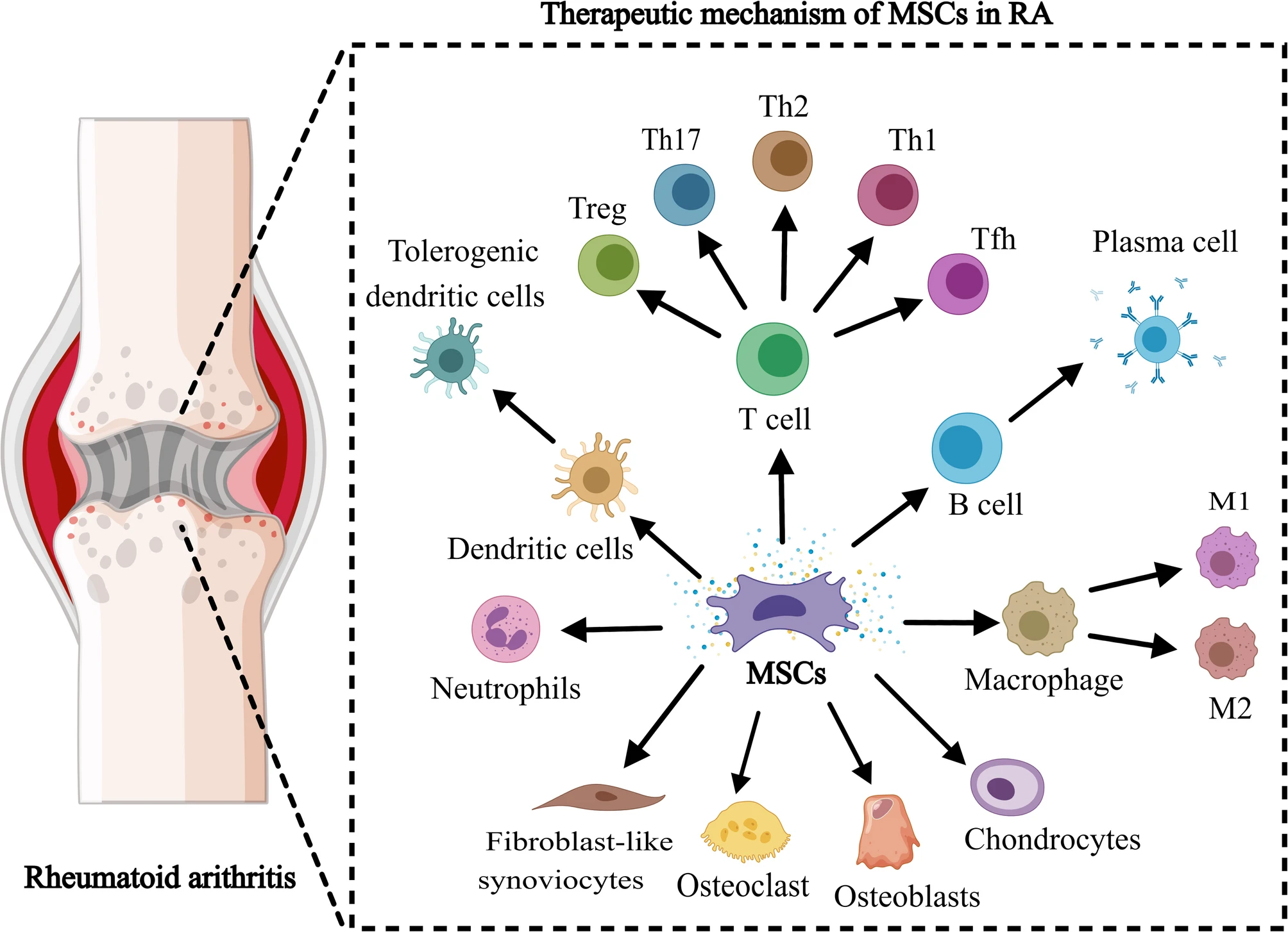 間充質干細胞治療類風濕性關節(jié)炎中的作用機制