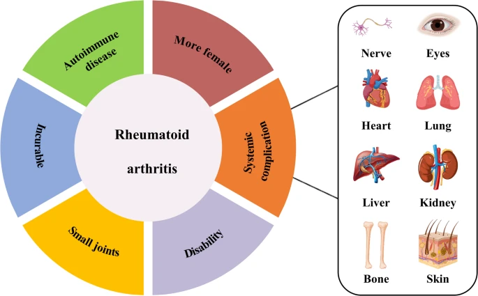 圖1：類風濕性關節炎的一般特征。