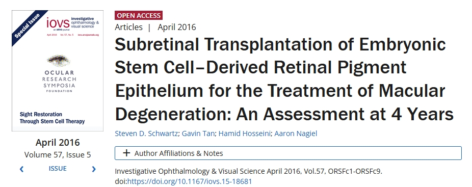 胚胎干細胞來源的視網膜色素上皮視網膜下移植治療黃斑變性：4年評估