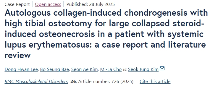 自體膠原誘導軟骨形成聯合脛骨高位截骨術治療系統性紅斑狼瘡患者大面積塌陷性類固醇性骨壞死：病例報告及文獻綜述