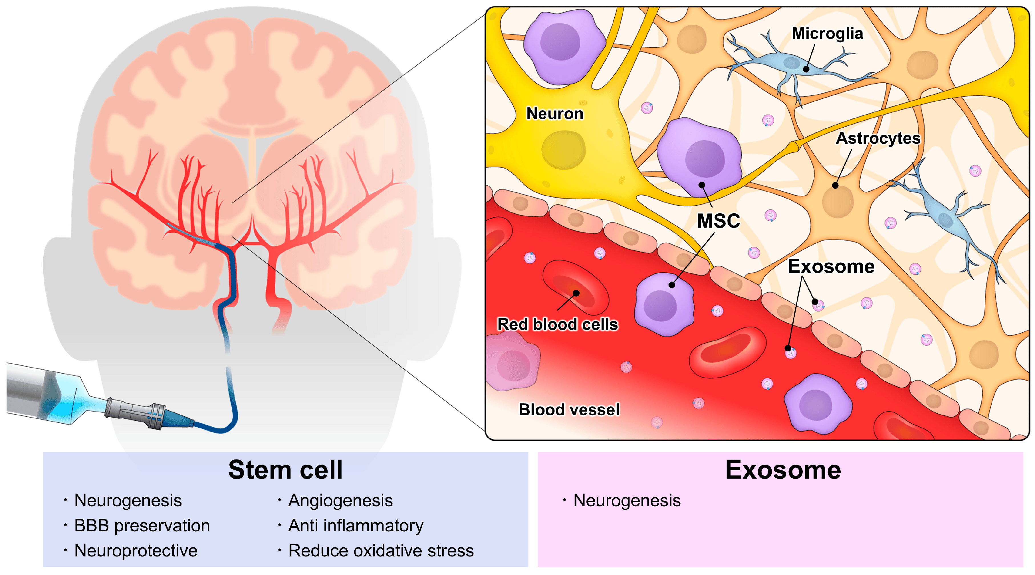 動脈注射干細胞&外泌體治療神經系統疾病，打多少細胞好？