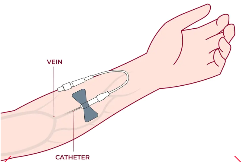 細胞通過靜脈輸注進行給藥，在某些情況下，可以使用其他輸送方法（例如鼻噴霧劑或局部應用）來針對特定系統。
