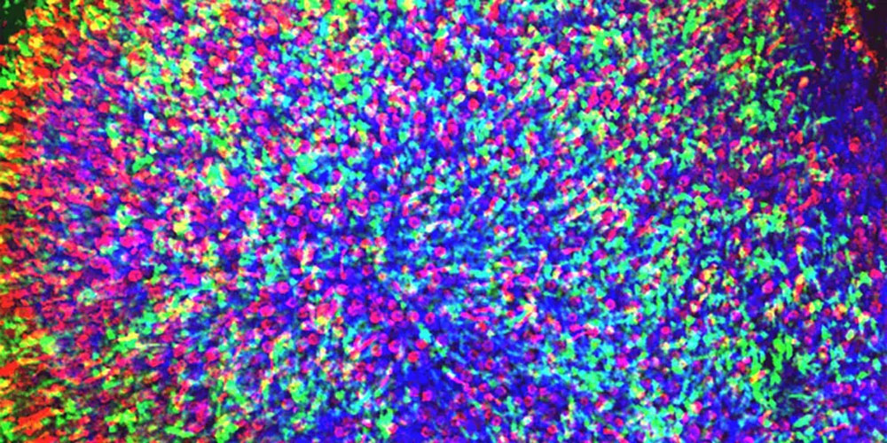 視網膜色素變性