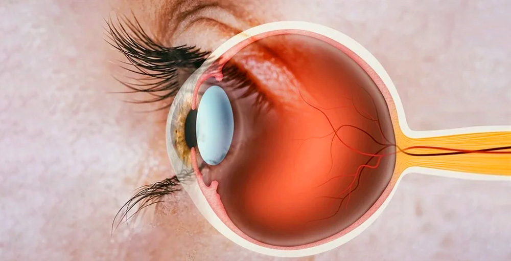 視神經(jīng)疾病