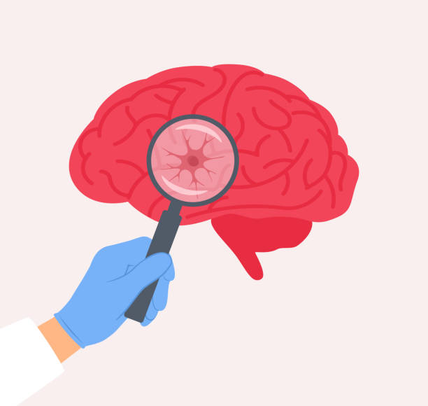 干細胞療法vs深部腦刺激：帕金森病進階治療方案療效對比