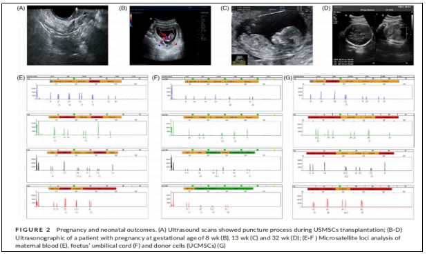 圖2：妊娠和新生兒結果。