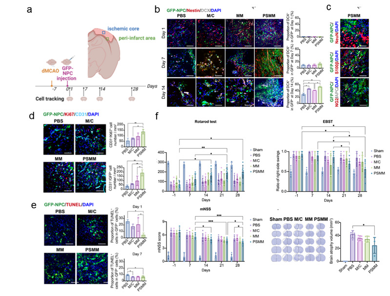負載NPCs的PSMM-基質復合支架促進大鼠卒中后損傷修復 負載NPCs的PSMM-基質復合支架促進大鼠卒中后損傷修復