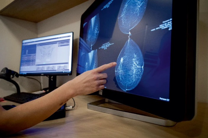 轉(zhuǎn)移性乳腺癌患者迫切需要新的治療方法。 轉(zhuǎn)移性乳腺癌患者迫切需要新的治療方法。